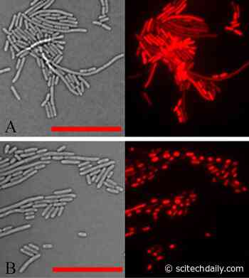 Plant Protein Kills Bacterial Cells – New Model for Antibacterial Mechanism Could Result in New Antibiotics