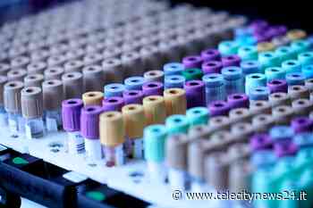 Coronavirus: aumento dei positivi a Casale, Valenza e Ovada - Telecity News 24