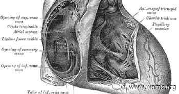 Medical Monday 5/2/22: Cardiology with Dr. James Lyons - WAMC