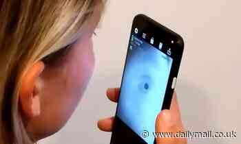 Smartphone app can detect signs of Alzheimer's and ADHD based on a selfie of your EYE