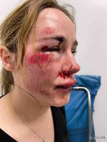 Indra (20) in Beernem voor dood achtergelaten nadat roekeloze bestuurder haar deed vallen: “Twee meter verder en ik zat onder zijn wagen” - KW.be - KW.be