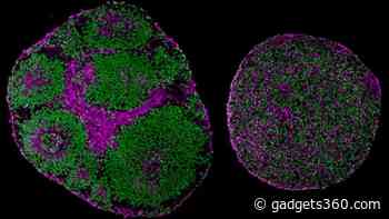 Autism-Linked Gene Mutation Reversed Using Lab-Grown Brain Experiment