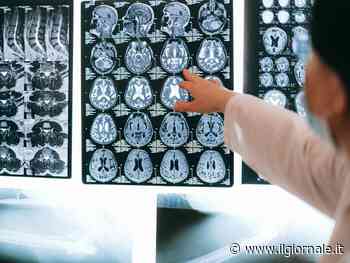 Covid, il cervello può invecchiare di 20 anni: cosa dice lo studio