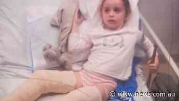 Girl breaks both legs at new playground - news.com.au