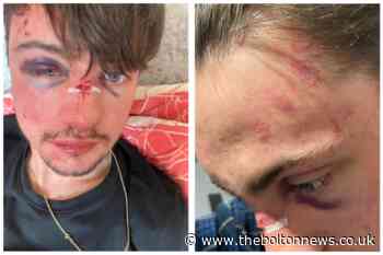 BOLTON: Man attacked minutes from his house in Daubhill - The Bolton News