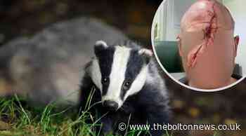 Bolton: Victim of 'badger baiter' attack calls for change to law - The Bolton News