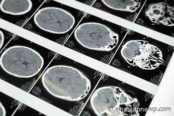 Guest View – AARP Rhode Island: How to sustain a healthy brain - What'sUpNewp