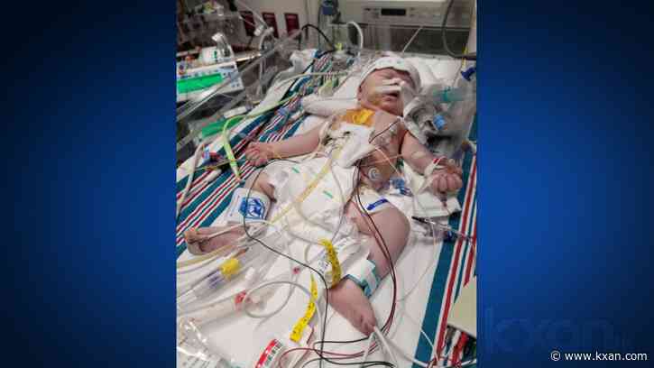 'He's a little warrior': Central Texas baby has open-heart surgery after birth