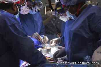 Virus Found In Pig Heart Used In Human Transplant Performed In Baltimore - CBS Baltimore