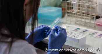 'Apple-shaped' women twice as vulnerable to some cancers, study finds - Grimsby Live - Grimsby Live