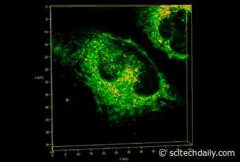 Stress Can Be Good – New Clues to Eliminating Build-Up of Toxic Proteins in Dementia