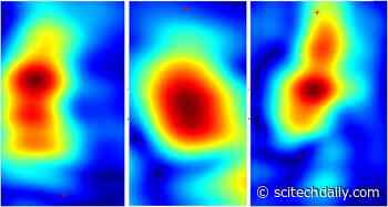 Bye, Bye, Biopsy? Handheld Device With New Imaging Tech To Painlessly Identify Skin Cancers