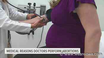 Medical reasons doctors perform abortions - Local 5 - weareiowa.com