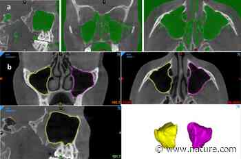 Convolutional neural network for automatic maxillary sinus segmentation on cone-beam computed tomographic images | Scientific Reports - Nature.com