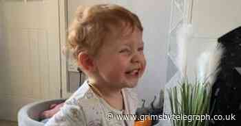 Little boy loses fingertips and toes after mum spots worrying rash - Grimsby Live - Grimsby Live