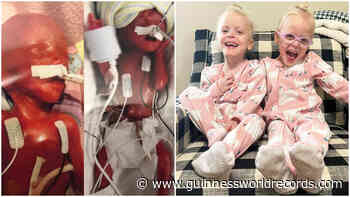 World's most premature twins now happy three-year-olds - Guinness World Records