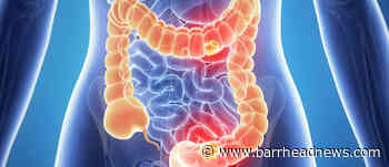 Bowel cancer: The signs and symptoms to be aware of - Barrhead News