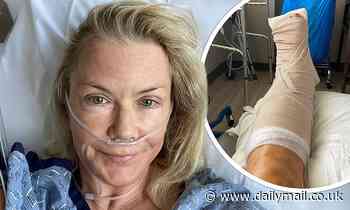 Katherine Kelly Lang undergoes surgery after falling down steep trail and shattering her ankle - Daily Mail