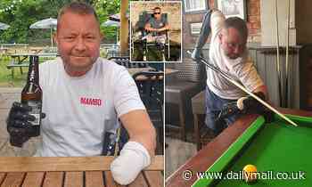 Gardener, 55, left without limbs due to rare illness can play pool again thanks to 'bionic arm' - Daily Mail