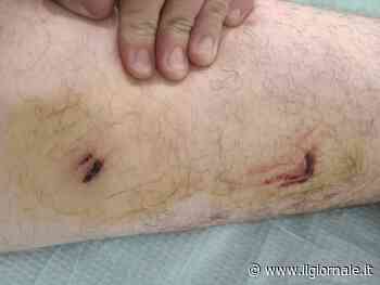 Aggredito da un pitbull nell'area dello spaccio: "Mentre mi mordeva i tossici ridevano"