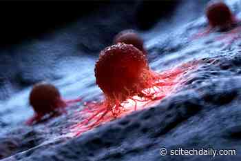 Yale Research Identifies Causes of Cancer