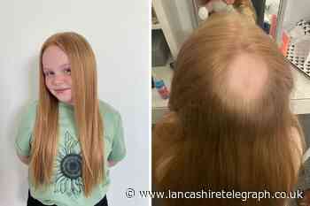 Thornton-Cleveleys girl with alopecia cutting hair off for charity