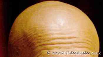 Calling man bald is sexual harassment, panel of 'balding' judges rule