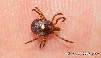 Woman with tick-induced meat allergy recalls life-threatening reaction: ‘Terrifying’