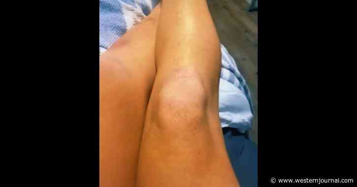 Athlete Discovers Tiny Dots on Her Skin Are Sign of Deadly Cancer