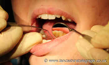 High rates of tooth decay among Blackburn's children revealed