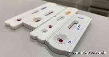 HIV: mais de mil pacientes fazem acompanhamento em Brusque; confira detalhes - O Município