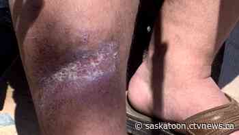 Saskatoon police union president believes officers charged in dog bite incidents 'acted lawfully' - CTV News Saskatoon