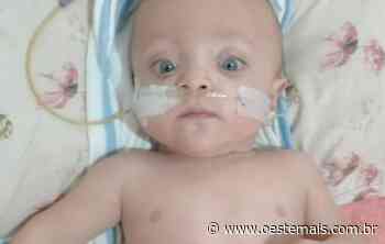 Bebê de Faxinal dos Guedes precisa de ajuda para realizar tratamento de doença grave - Oeste Mais