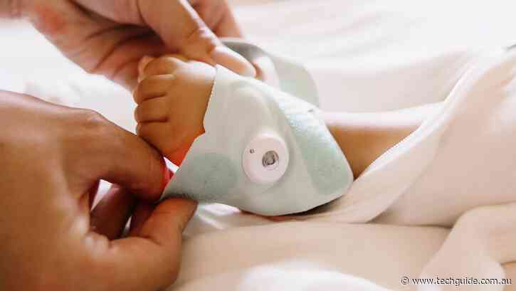 Owlet Smart Sock lets you monitor your baby in a whole new way