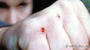 Kamenz: Mann verletzt Zugbegleiter wegen Hinweis auf Maskenpflicht - Dresdner Neueste Nachrichten