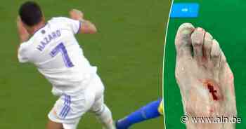 Eden Hazard pakt geel na pittige fout, slachtoffer breekt twee botjes en stelt zich vragen bij sanctie - Het Laatste Nieuws