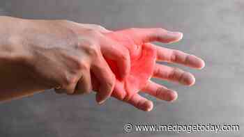 Acute Extremity Pain in Patient With Cogan's Syndrome Signals Vascular Ischemia