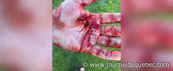 Un maître et son chien attaqués par deux molosses