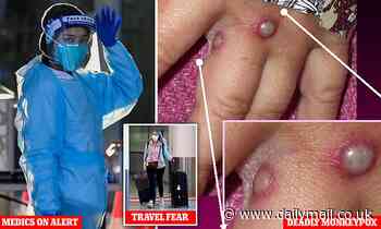 Australian health authorities on high alert over deadly 'monkeypox' virus