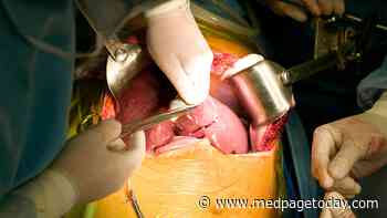 MELD Scoring for Liver Transplants in Need of Sex Adjustment, Study Says