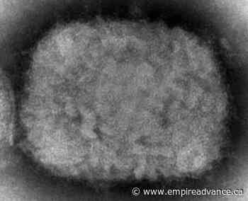 US case of monkeypox reported in Massachusetts man - Virden Empire Advance