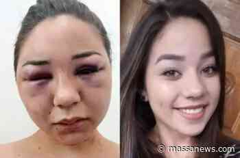 Acusado de agredir e deixar jovem com rosto desfigurado em Tapejara é condenado - Massa News