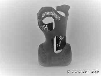 A 3D printed orthotic device made from castor oil