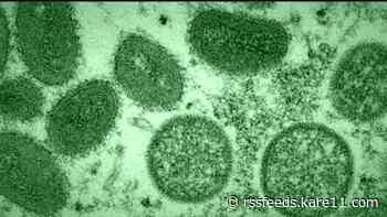 New monkeypox cases highlight importance of tracking zoonotic diseases