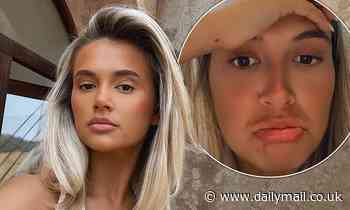 Molly-Mae Hague reveals why she has been absent on social media 