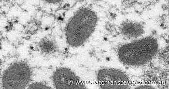 Monkeypox in Italy, Sweden as WHO on alert - Bay Post-Moruya Examiner