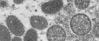 Variole du singe: trois cas en Belgique liés à un festival de mode fétichiste