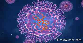 Is Monkeypox Fatal, or Even New? What to Know About Symptoms and More     - CNET