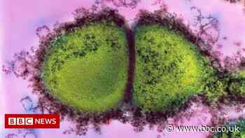Blackpool death: Abortion sepsis risk training inadequate - coroner