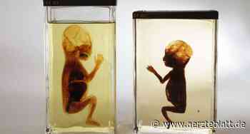 Anatomische Sammlung in der Uniklinik Jena neu gestaltet - Deutsches Ärzteblatt: Aktuelles aus Gesundheitspolitik und Medizin